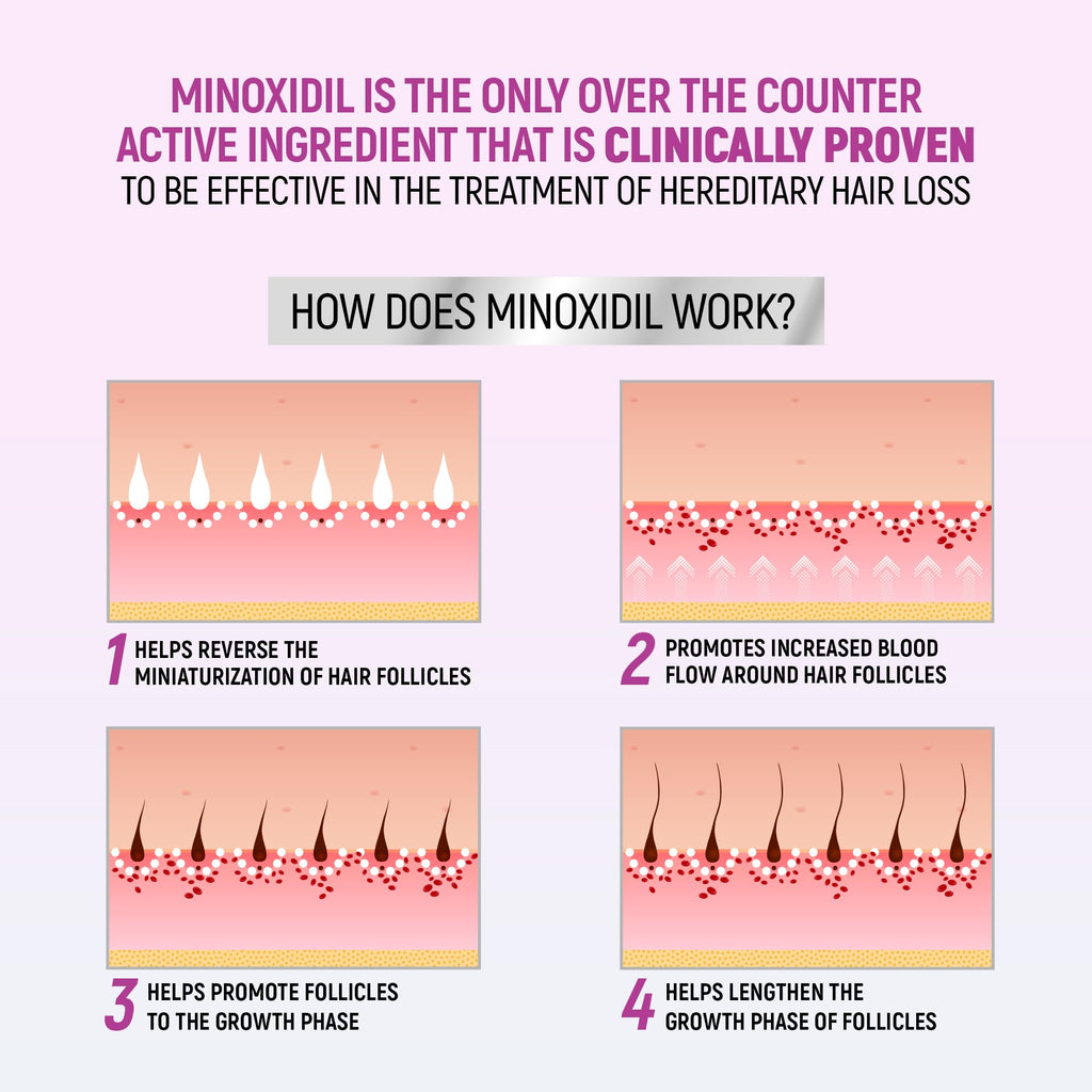 Minoxidil for Women, 2.11 Oz (2 Months Supply) Clinically Proven to Regrow Hair, Topical Aerosol Foam 5%, Hair Thinning Treatment