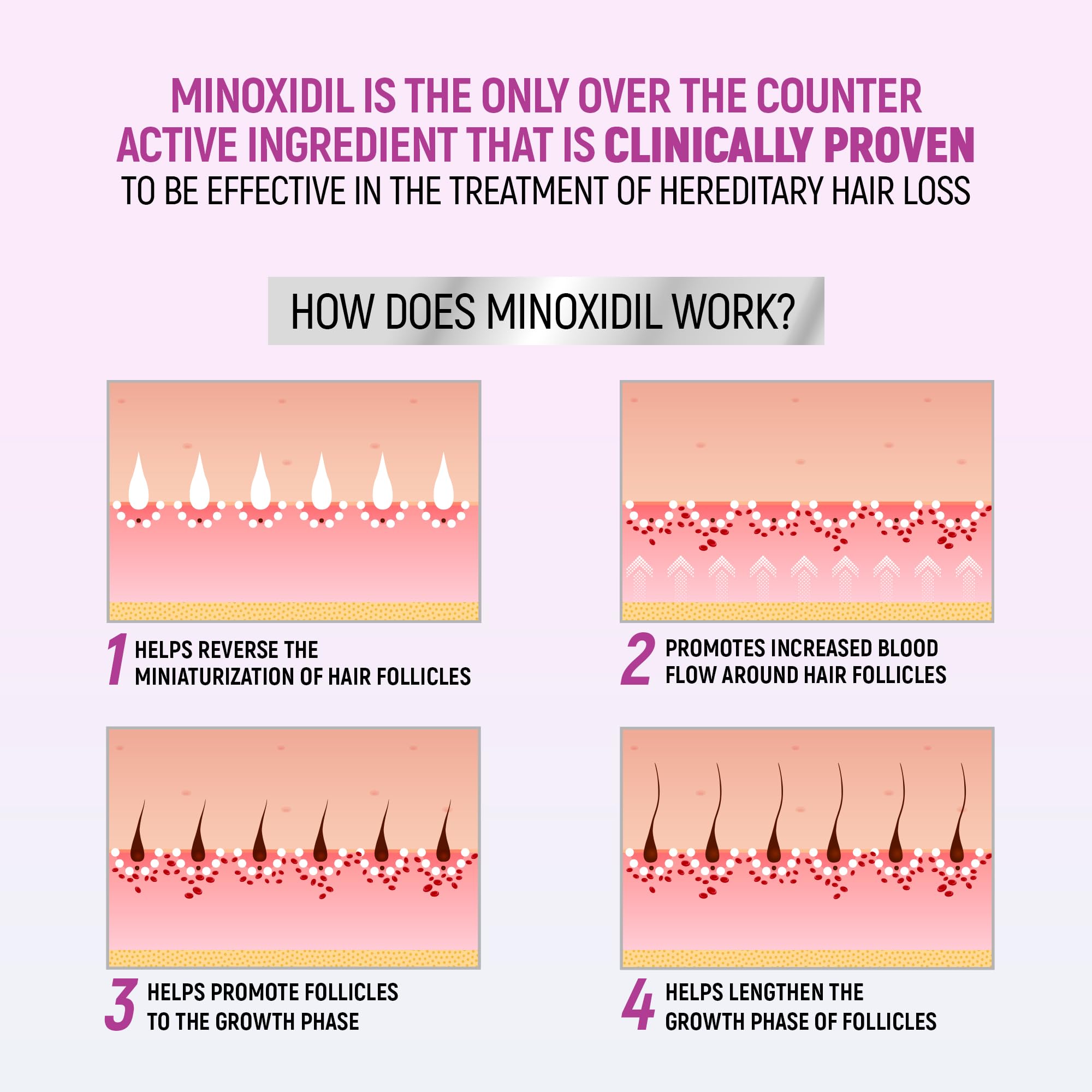 Minoxidil for Women, 2.11 Oz (2 Months Supply) Clinically Proven to Regrow Hair, Topical Aerosol Foam 5%, Hair Thinning Treatment