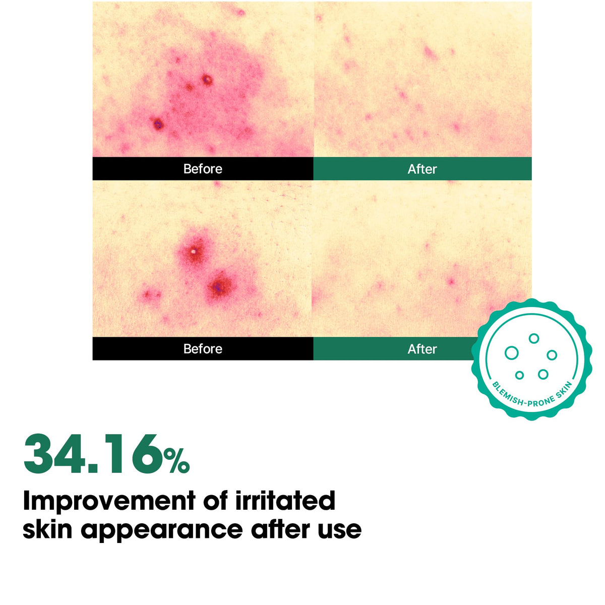 SOME BY MI AHA BHA PHA 30 Days Miracle Body Toner Mist – 4.73oz, 140ml – Body Spray for Back & Chest, Body Mist with Tea Tree, Niacinamide – Korean Skincare