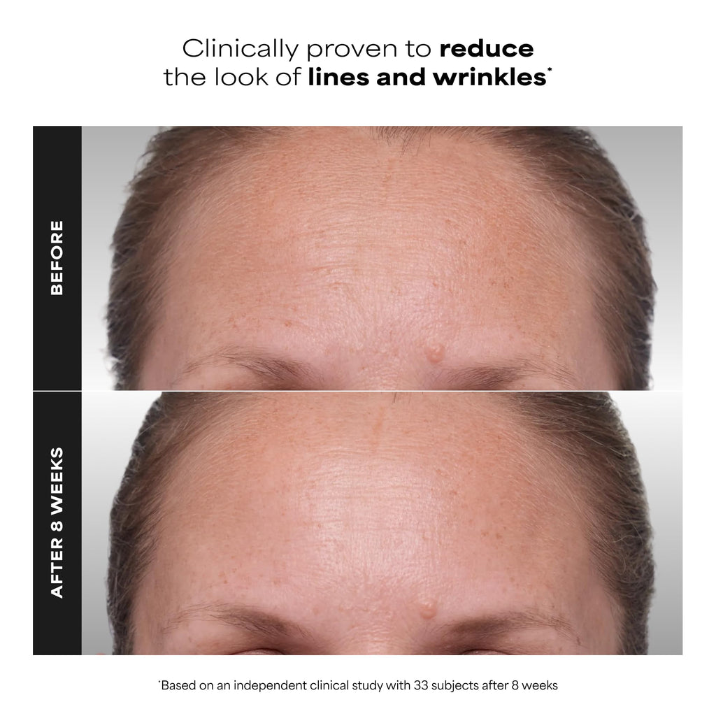 Paula's Choice CLINICAL 1% Retinol Face Treatment with Peptides | Anti-Aging Face Serum with Vitamin C & Licorice Extract for Fine Lines & Wrinkles, Fragrance Free