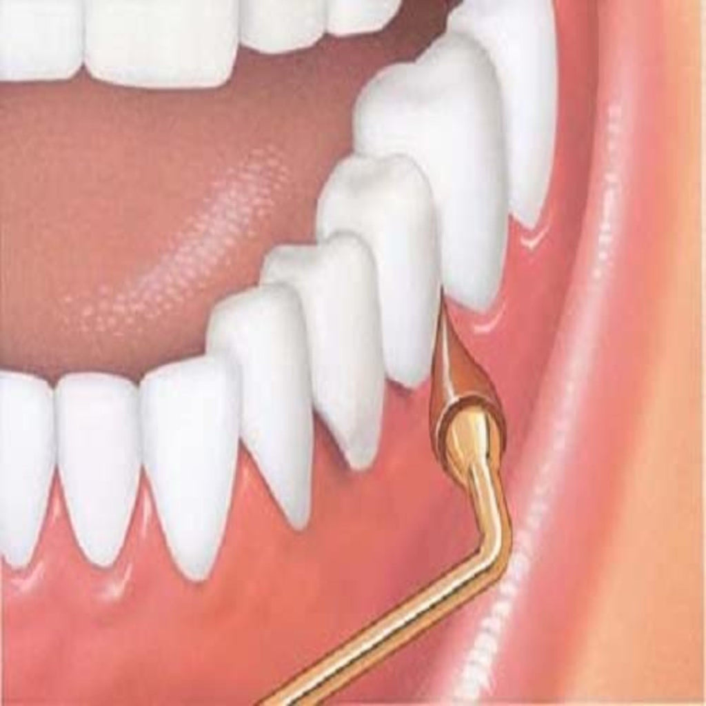 GUM Stimulator Permanent Handle with Rubber Tip, 1 Handle + 2 Refill Packs