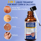 Wart Remover Liquid - Gentle Formula for Plantar Warts, Common & Corn on Feet, Hands and Other External Areas - Salicylic Acid - NET WT: 30ml/ 1fl oz