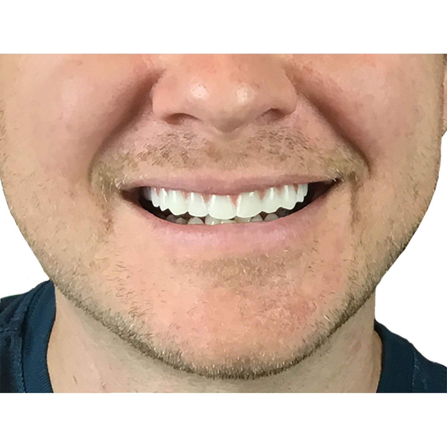 Buy now Instant Smile Comfort Fit Flex Natural Shade at indiglob india