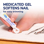 Dr. Scholl's INGROWN TOENAIL PAIN RELIEVER & TRIMMING KIT, 0.3 oz // Only OTC Treatment Proven to Relieve Ingrown Toenail Pain - Includes Medicated Gel + Foam Rings + Bandages + Clipper & Pusher Tools