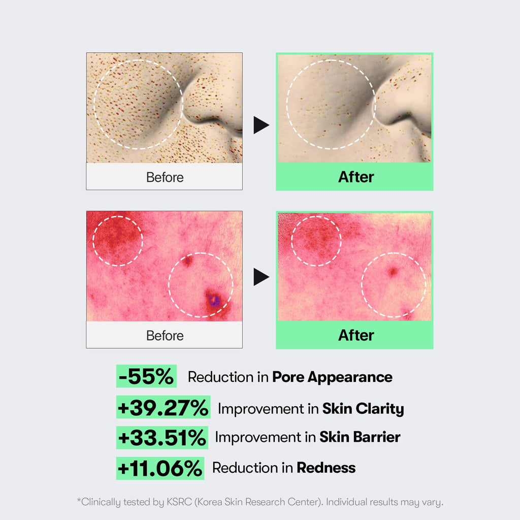 VT COSMETICS CICA Reedle Shot 100 Microneedling Serum | Spicule, Pore Care & Exfoliation, Exosome, Centella Asiatica for Glass Skin, Skin Texture