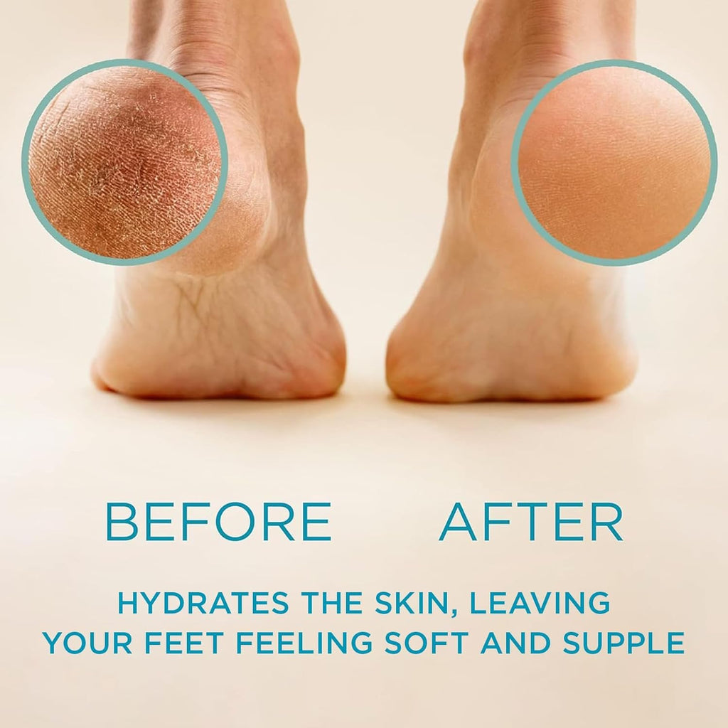 Buy now Lee Beauty Professional Callus Remover for Feet - Original, Powerful Formulation - Extra Strength Gel, Home Pedicure Foot Spa Results - Cracked & Dead Dry Skin Supplies - 8 Oz at indiglob india