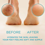 Buy now Lee Beauty Professional Callus Remover for Feet - Original, Powerful Formulation - Extra Strength Gel, Home Pedicure Foot Spa Results - Cracked & Dead Dry Skin Supplies - 8 Oz at indiglob india