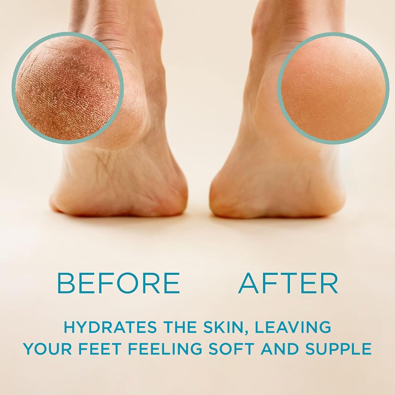 Buy now Lee Beauty Professional Callus Remover for Feet - Original, Powerful Formulation - Extra Strength Gel, Home Pedicure Foot Spa Results - Cracked & Dead Dry Skin Supplies - 8 Oz at indiglob india