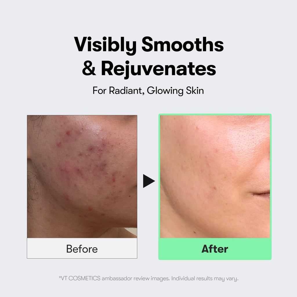 VT COSMETICS CICA Reedle Shot 100 Microneedling Serum | Spicule, Pore Care & Exfoliation, Exosome, Centella Asiatica for Glass Skin, Skin Texture