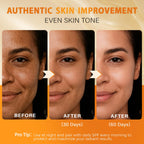 QOOQ Turmeric Kojic Acid Soap for Dark Spot Remover - Facial Cleansing Bar | Vitamin C, Retinol, Collagen, Vitamin E, Glycerin,Shea Butter & Castile Olive Oil – Soap for Women and Men Gifts(120g x 2)