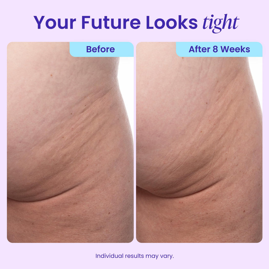 goPure Firming Butt & Thigh Cream - Skin Tightening Cream for Body with 8% MaxLift3 Complex - Visibly Smooths Stretch Marks - Cellulite Cream & Crepe Solution - Hydrating Barrier - Clinically Tested