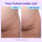 goPure Firming Butt & Thigh Cream - Skin Tightening Cream for Body with 8% MaxLift3 Complex - Visibly Smooths Stretch Marks - Cellulite Cream & Crepe Solution - Hydrating Barrier - Clinically Tested
