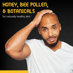 Bee Bald HEAL Aftershave for Men, Calm & Soothes, After Shave Balm, 2 fl oz | Immediately Calms & Soothes Irritated Skin. Treats Razor Burn, Redness, Bumps on Head or Face. Perfect For Sensitive Skin.