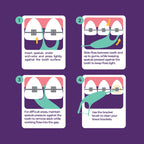 Platypus Orthodontic Flossers for Braces, 30 Count (Pack of 1)