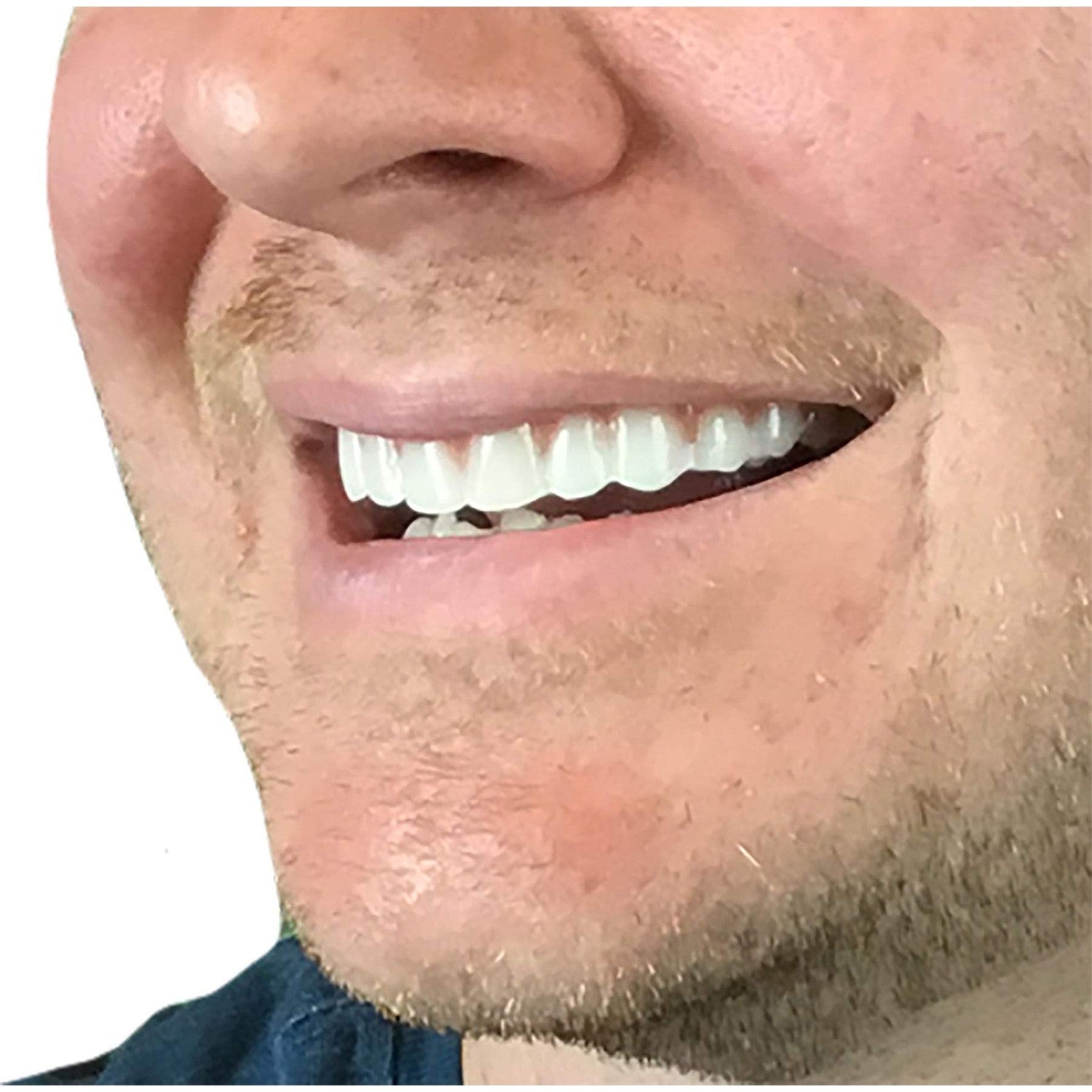 Buy now Instant Smile Comfort Fit Flex Natural Shade at indiglob india