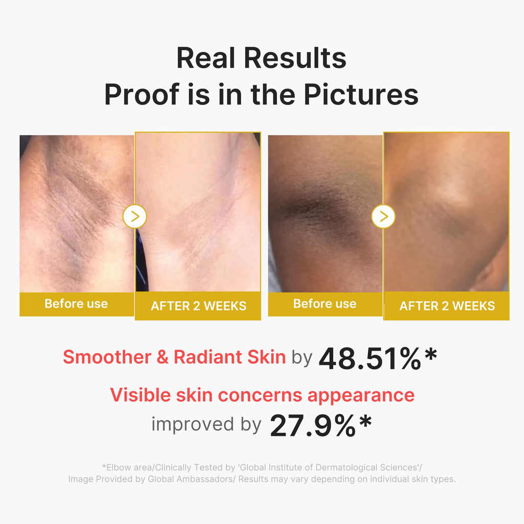 medicube Body Peel Shot with Kojic Acid and Turmeric | Gentle Body Brightening & Exfoliating with BHA LHA PHA - Dead Skin Cells, Uneven Looking Skin & Excess Sebum, 9.46 fl.oz