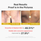 medicube Body Peel Shot with Kojic Acid and Turmeric | Gentle Body Brightening & Exfoliating with BHA LHA PHA - Dead Skin Cells, Uneven Looking Skin & Excess Sebum, 9.46 fl.oz