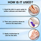 Foot Pumice Stone 4 Pack Pedicure Stone for Feet (Purple) | for Feet Callus Remover and Scrubber Double Sided Pedicure Foot Pumice Stone for Feet and Heels Callus and Dead Skins