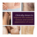 Mederma Advanced Scar Gel, Cepalin Scar Treatment, Old and New Scars, 50g