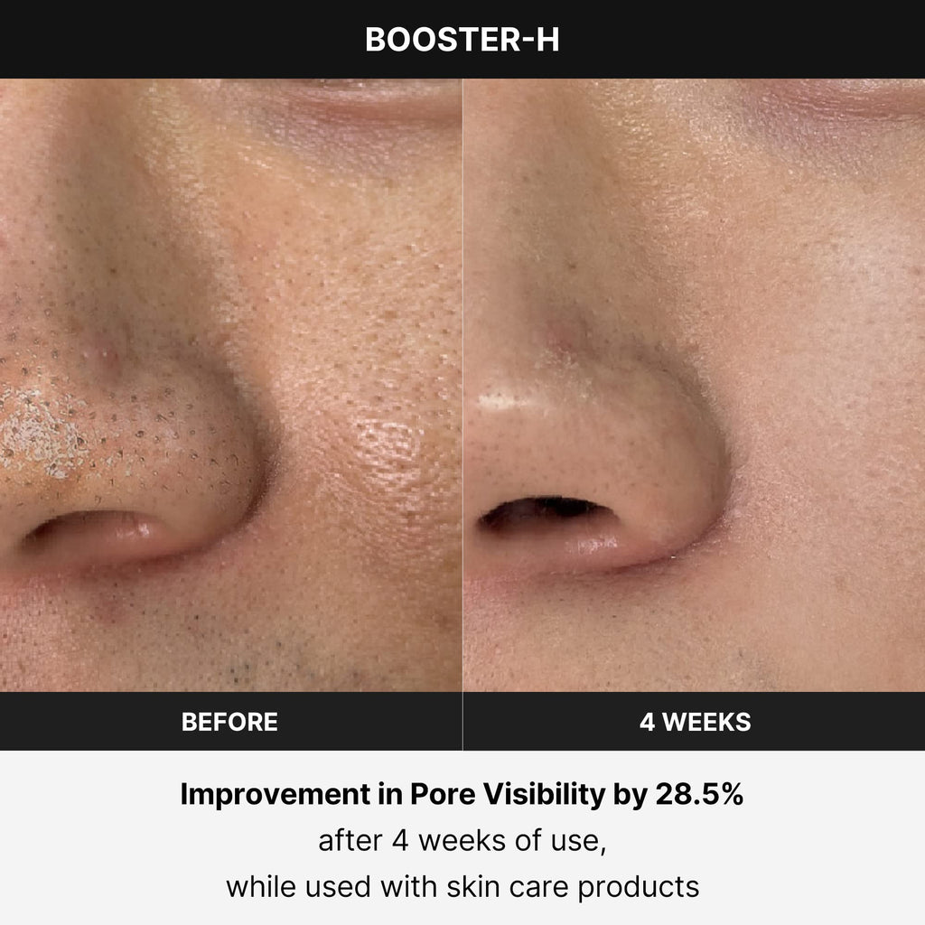 Buy now medicube Booster H - Korean Skincare Tool - Facial Glow Booster for Maximizing and Boosting Skin Care Absorption - Needle Free at indiglob india