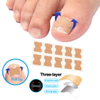 Professional Ingrown Toenail Toolkit, Ingrown Nail Corrector