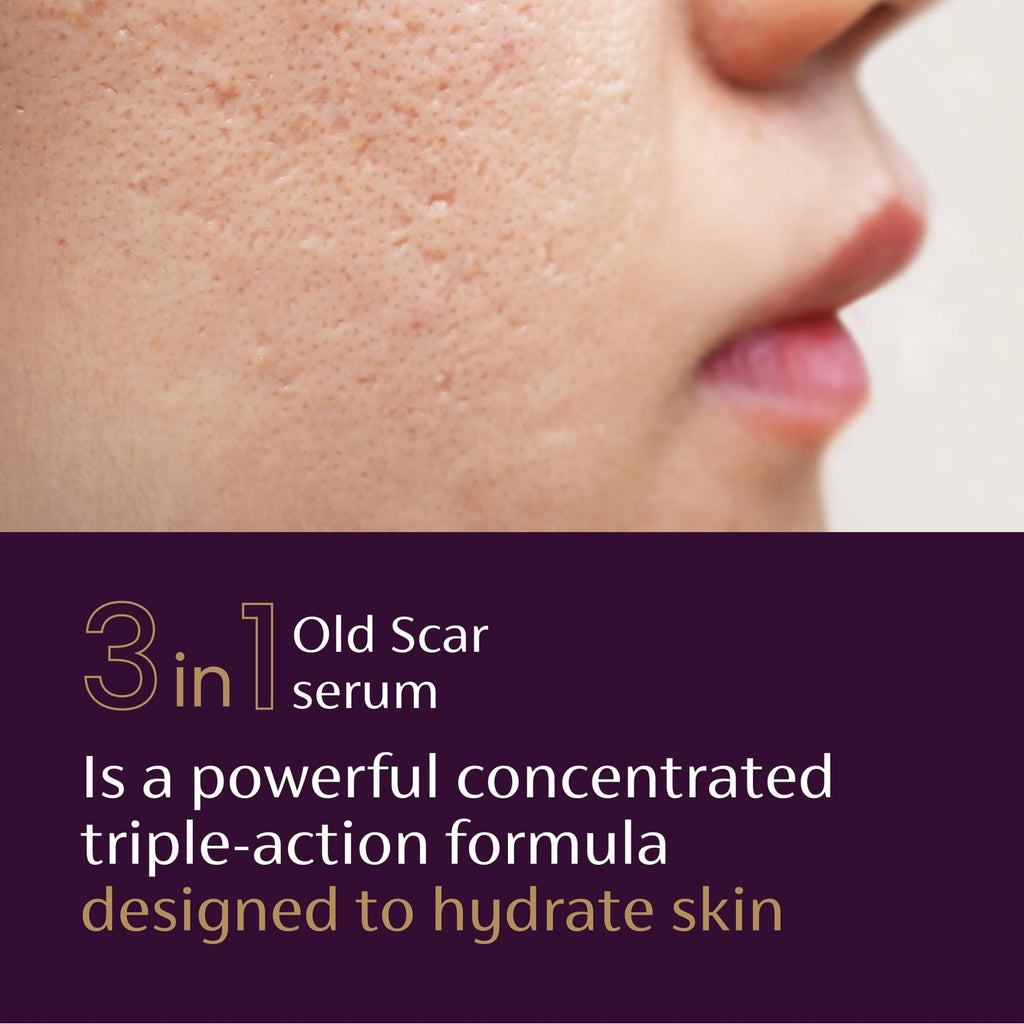 Mederma Scar Serum – Triple-Action Formula with Vitamin E, Hyaluronic Acid & Niacinamide – Clinically Shown to Reduce Old Scars, 1 Fl. Oz.
