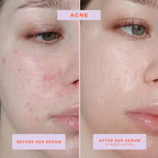 Buy now Tower 28 SOS Rescue Face Serum - Soothing Facial Serum with Hypochlorous Acid for Irritated, Sensitive Skin - Gently Helps Reduce Redness + Blemishes - Fragrance-Free Everyday Skin Care (2 oz) at indiglob india
