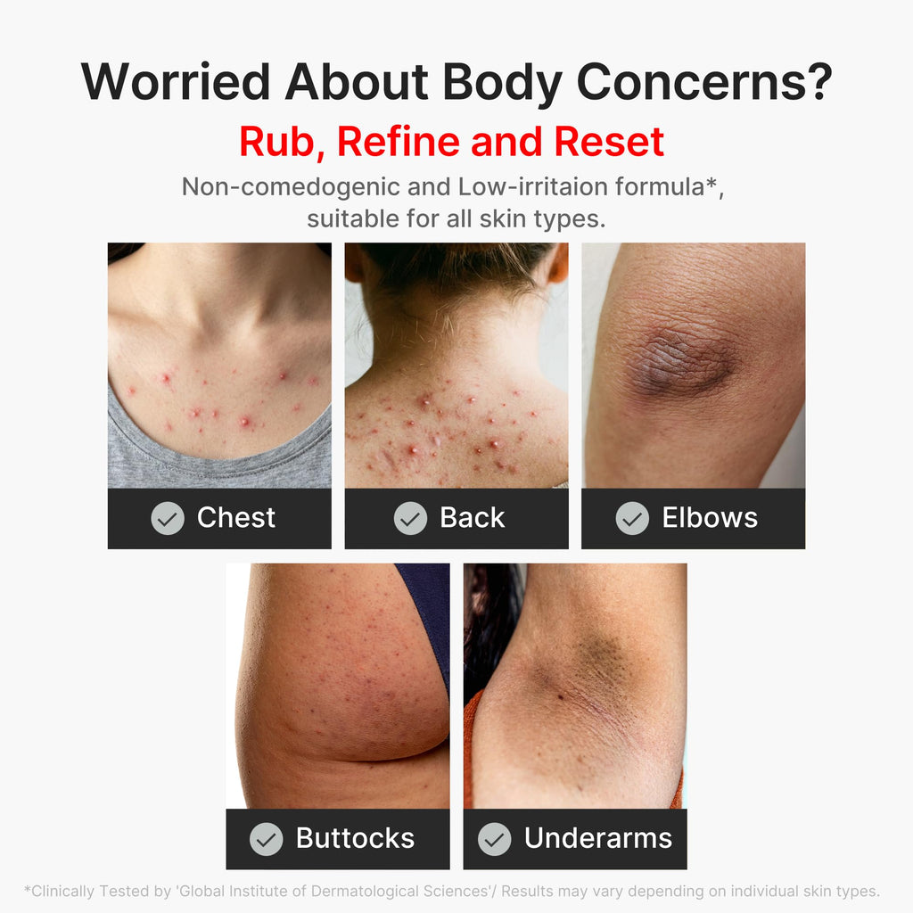 medicube Body Peel Shot with Kojic Acid and Turmeric | Gentle Body Brightening & Exfoliating with BHA LHA PHA - Dead Skin Cells, Uneven Looking Skin & Excess Sebum, 9.46 fl.oz