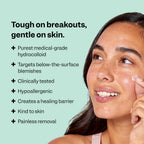 Peach Slices - Deep Blemish Microdarts (9 ct) - Early Stage Pimple Patches for Face - Salicylic Acid, Niacinamide, Hyaluronic Acid, Tea Tree Oil & Cica - Vegan, Cruelty Free, Korean Skin Care & Beauty | Salicylic Acid
