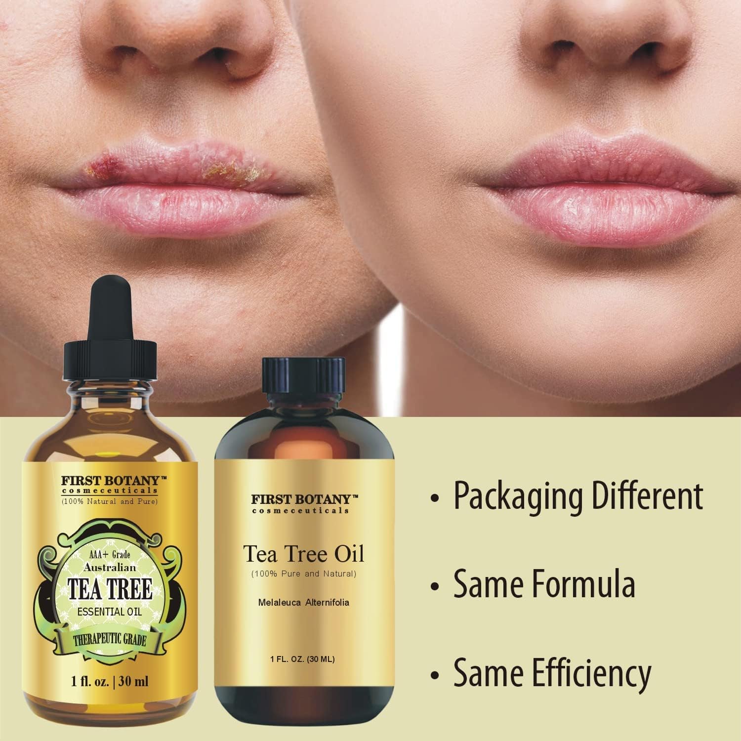Buy now First Botany, 100% Pure Australian Tea Tree Essential Oil with high conc. of Terpinen - A Known Solution to Help in Fighting Acne, Toenail Issues, Dandruff. (1 fl oz) at indiglob india