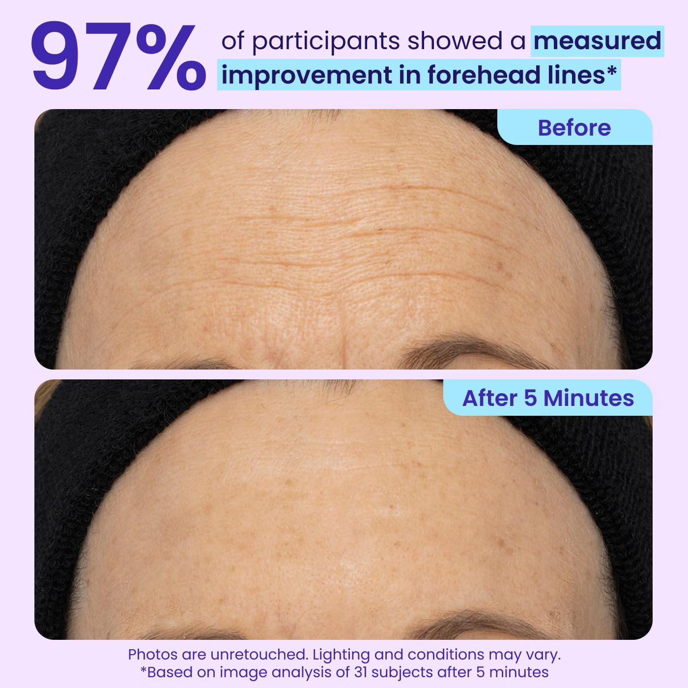 goPure NEW Instant Lift Eye Gel - To Imrove the look of Eye Bags, Wrinkles, Fine Lines and Dark Circles, Anti Aging Skin Care with MaxLift3 Biotech