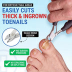 Toenail Clippers for Thick Toenails – KLIPP 15 mm Wide Jaw Thick Fingernail and Toenail Cutter with Curved Stainless-Steel Blades for Seniors (Eagle Beak)