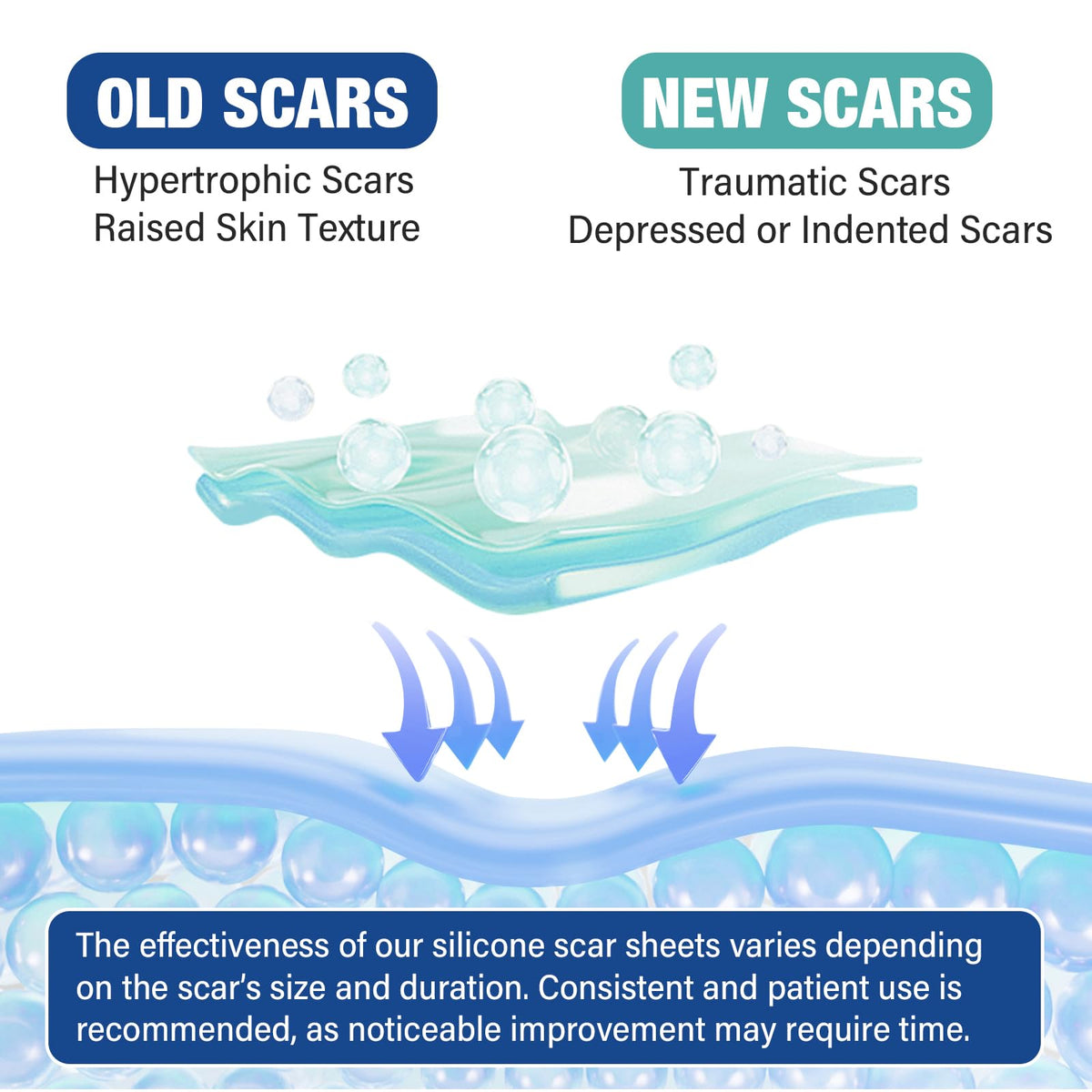 Silicone Scar Sheets, Silicone Scar Tape(1.6"x 158" Roll-4 meters), Silicone Scar Sheets for Surgical Scars, Scar Tape for Surgical, C-Section, Burn, Hypertrophic & Keloid Scars