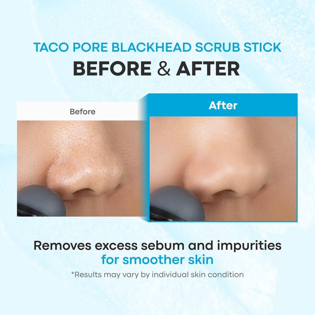 TONYMOLY Tako Pore Clay Scrub Stick, Korean Blackhead Exfoliator, 0.8 oz | Bentonite and kaolin clay draw out blackheads and sebum - Witch hazel and tea tree oil refine and unclog pores