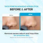 TONYMOLY Tako Pore Clay Scrub Stick, Korean Blackhead Exfoliator, 0.8 oz | Bentonite and kaolin clay draw out blackheads and sebum - Witch hazel and tea tree oil refine and unclog pores