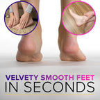 NYK1 RUSTPROOF Foot File Callus Remover for Feet with Catcher | XL Size | MegaFile Hard Skin Remover Foot Scraper for Wet and Dry Use - Non-Slip Textured Grip for Smooth, Soft & Callus-Free Feet