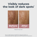 Eucerin Radiant Tone Dual Serum Dark Spot Corrector, Dark Spot Serum with Thiamidol and Hyaluronic Acid, 1 Fl Oz Bottle