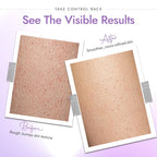 DERMAdoctor KP Bump Eraser Body Scrub, 10% AHAs + PHAs, Rough & Bumpy Skin