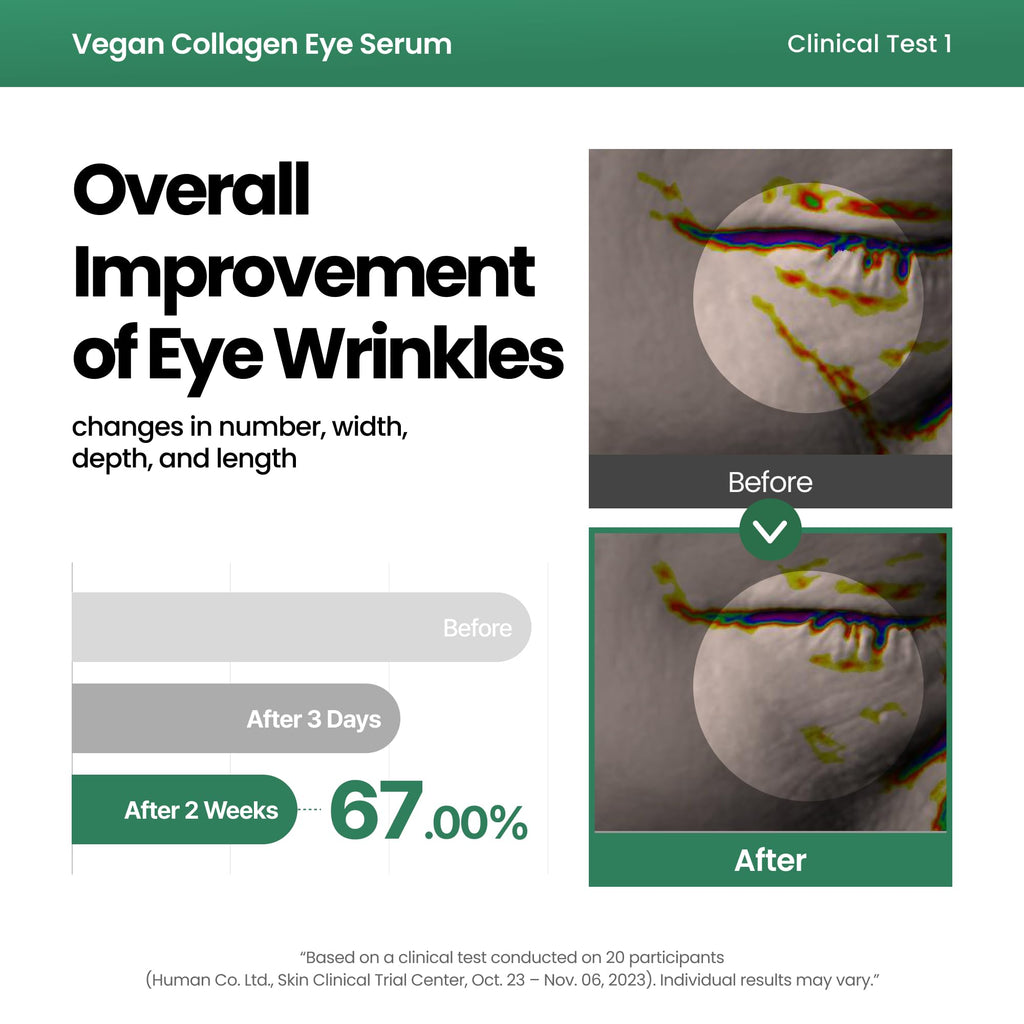 AXIS-Y Vegan Collagen Eye Serum with 2% Niacinamide, Peptides, 0.33 fl. oz. | Vegan Korean Eye Cream with Cooling Roller for Wrinkles, Fine Lines, Dark Circles, Puffiness & Deep Hydration