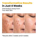 QUIA Turmeric + Kojic Acid Overnight Wrapping Mask – Hydration Mask for Glowing Skin – Evens Tone, Soothes Redness and Improves Skin Texture – Korean Skincare 75ML