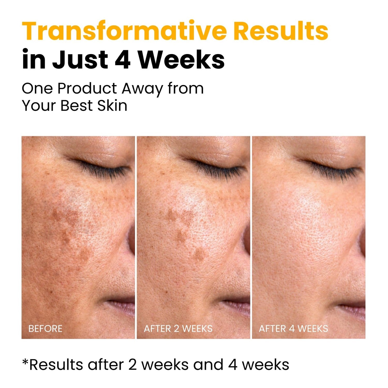 QUIA Turmeric + Kojic Acid Overnight Wrapping Mask – Hydration Mask for Glowing Skin – Evens Tone, Soothes Redness and Improves Skin Texture – Korean Skincare 75ML
