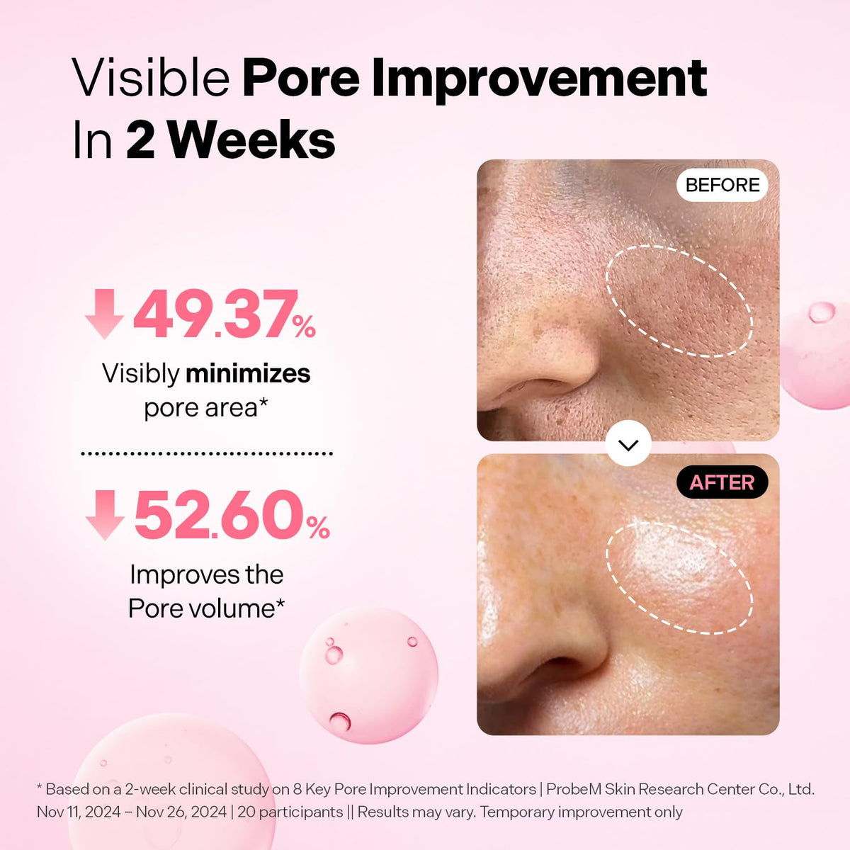 Torriden CELLMAZING Pore Perfecting Ampoule 30ml (1.01 fl.oz.) | Improving Skin Elasticity | 5D Collagen, Peptide Complex, PHA, LHA | Korean Facial Serum, Korean Skin Care
