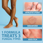 Curist Terbinafine Cream Antifungal 1 oz (30g) Foot Fungus Treatment 1%