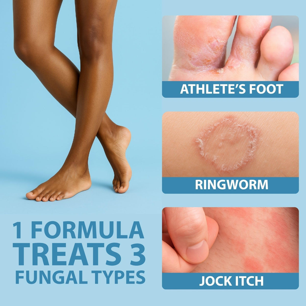 Curist Terbinafine Cream Antifungal 1 oz (30g) Foot Fungus Treatment 1%