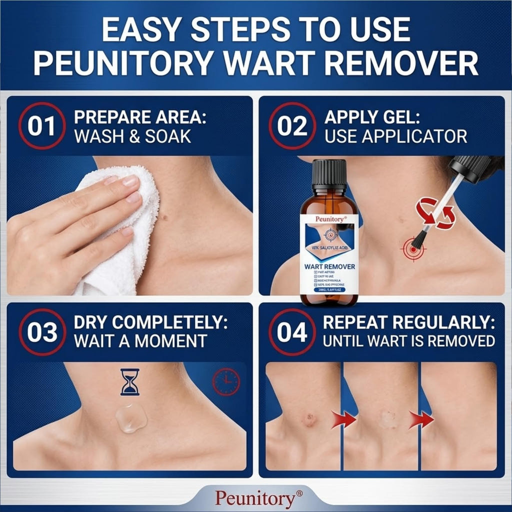 Peunitory 40% Salicylic Acid Wart Remover Liquid, Fast-Acting Wart Remover for Common & Plantar Warts, Maximum Strength Salicylic Acid Wart Remover for Hands, Feet, Neck & Body, 1.01 fl oz