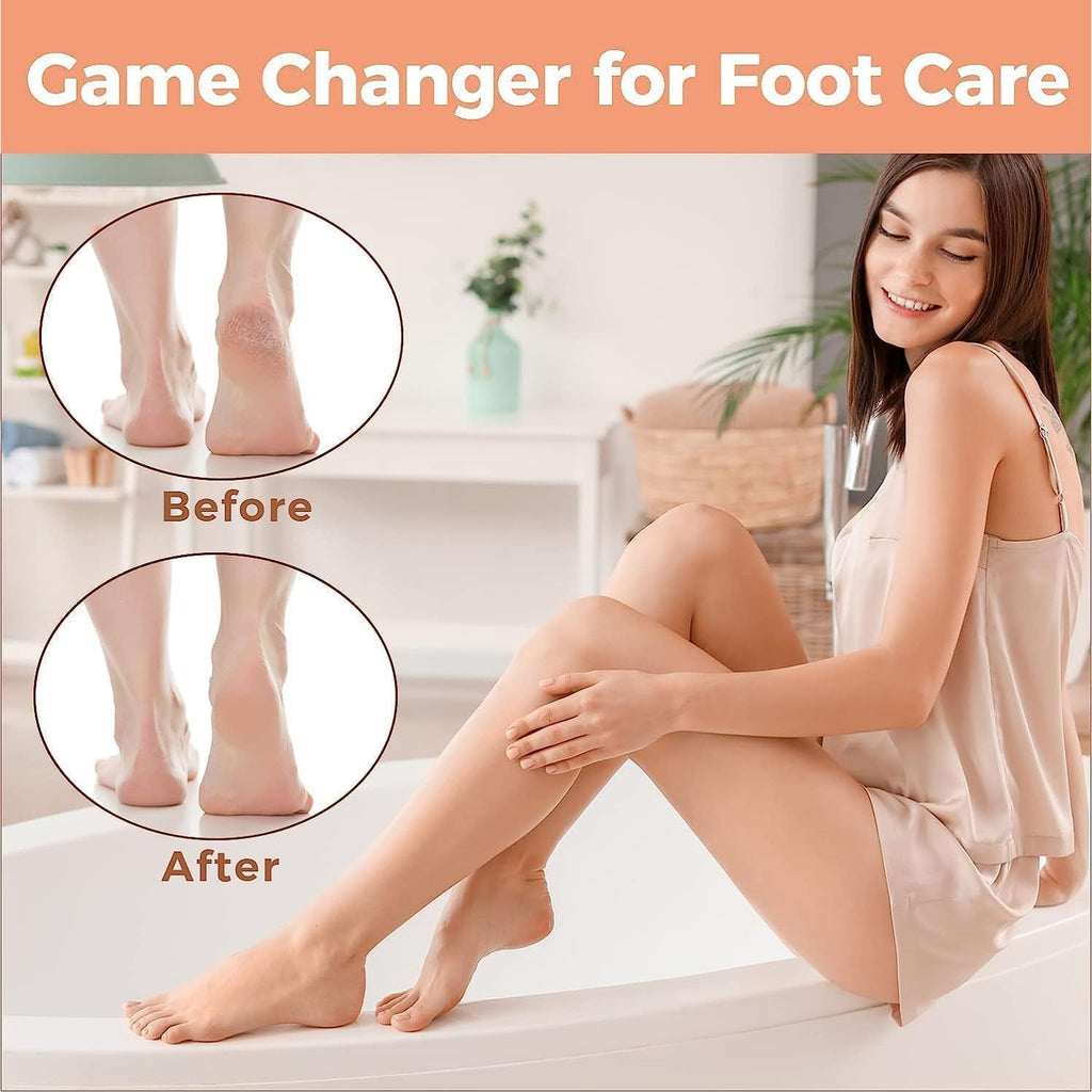 Foot File Foot Scrubber Pedicure - Callus Remover for Feet Easkep Professional Grater Rasp Foot Scraper Corns Callous Removers Cracked Dead Skin Remover for Dry and Wet Feet (Golden Set)
