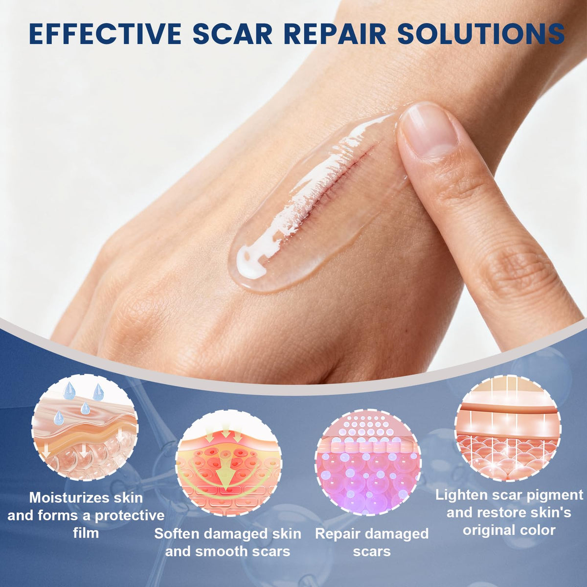 Rvlaim 100% Advanced Silicone Scar Gel for Old & New Scars,1.7oz/50ml