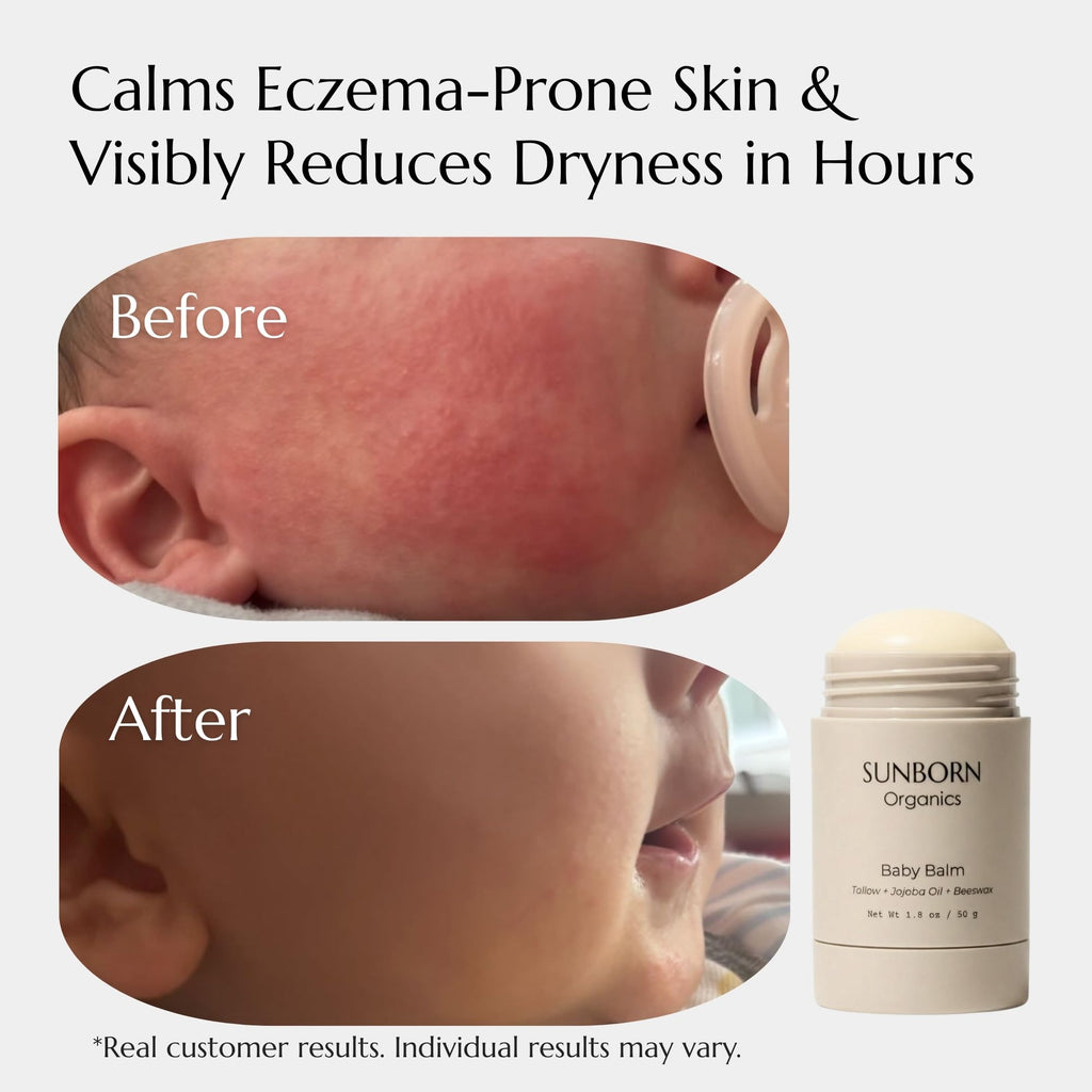 Baby Balm | 3 Natural Ingredient Moisturizing Stick for Eczema Relief, Sensitive Skin & Diaper Rash | Grass-Fed Tallow, Organic Jojoba & Beeswax | Lab Tested Baby-Safe, Made in USA