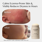 Baby Balm | 3 Natural Ingredient Moisturizing Stick for Eczema Relief, Sensitive Skin & Diaper Rash | Grass-Fed Tallow, Organic Jojoba & Beeswax | Lab Tested Baby-Safe, Made in USA