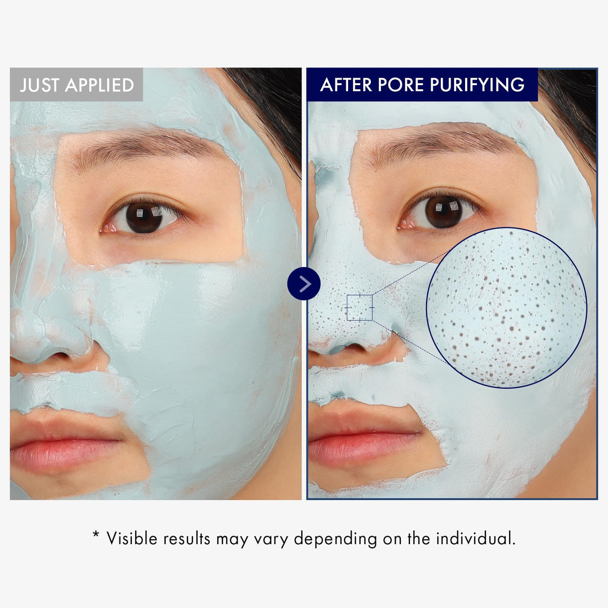 TOSOWOONG Real Blackhead Mud Mask for Pore Care, Oil Control, Cooling